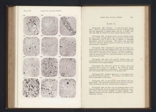 Twelve enlargements of lymphocytes