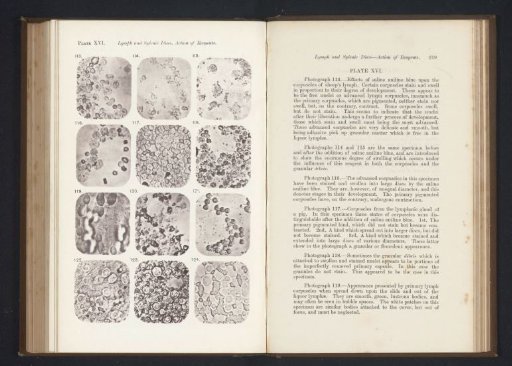 Twelve enlargements of the effects of salt solution on lymphocytes