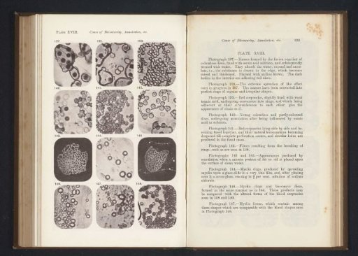 Twelve enlargements of red blood cells and myelin