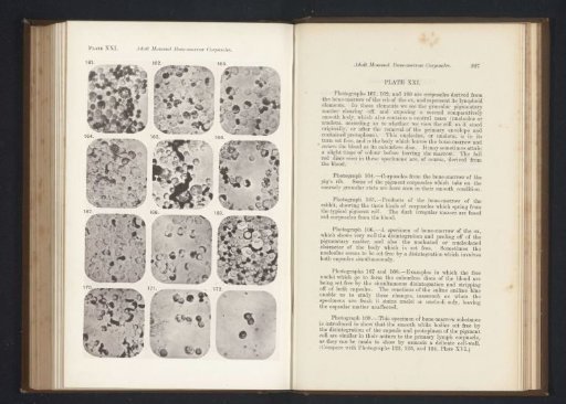 Twelve enlargements of blood corpuscles in bone marrow