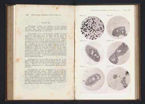 Six enlargements of blood cells