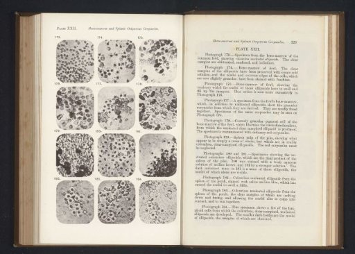 Twelve enlargements of bone marrow