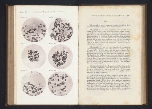 Six enlargements of blood cells