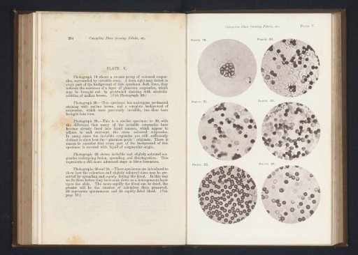 Six enlargements of blood cells