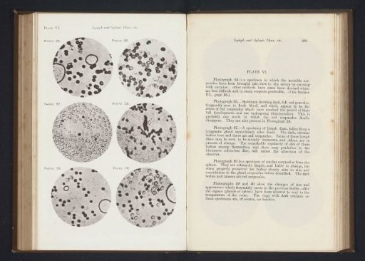Six enlargements of blood cells and lymphocytes