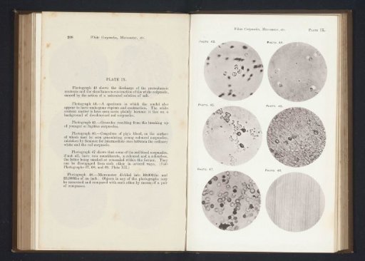 Five enlargements of blood and a micrometer