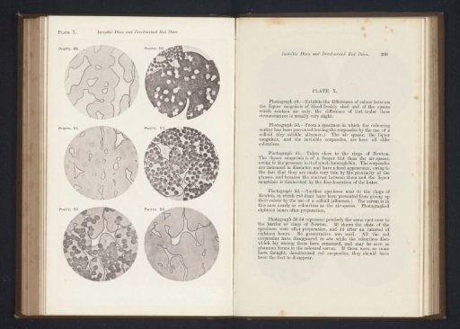 Six enlargements of blood after various interventions