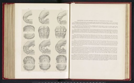 Photographic reproduction of drawings of a horse's dentition