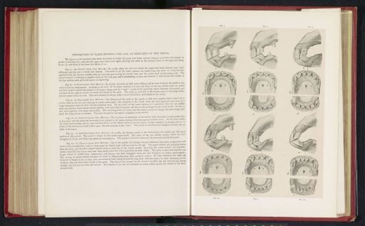Photographic reproduction of drawings of a horse's dentition