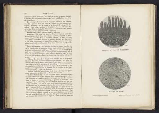 Section of villi of duodenum
