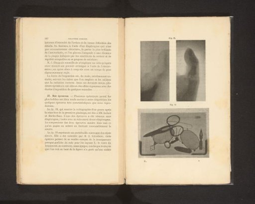 X-ray photographs of a thumb and a portfolio containing among other things a pair of scissors, a key, and a crown pen
