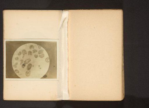 Microscopic Photograph of Lily Pollen