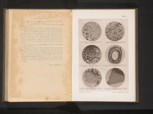 Six microscopic photographs of bacteria and bacilli