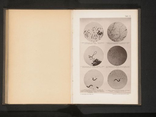 Six microscopic photographs of bacteria and eubacteria
