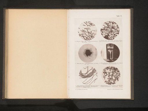 Six microphotographs of the anthrax bacillus