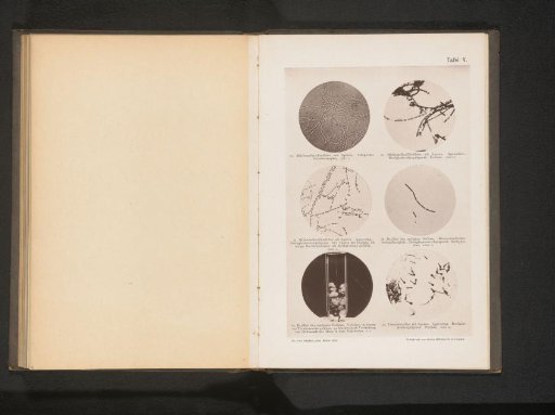 Six microphotographs of bacteria, including the anthrax bacillus