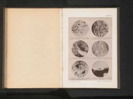 Six microphotographs of bacteria, including tuberculosis and leprosy bacilli