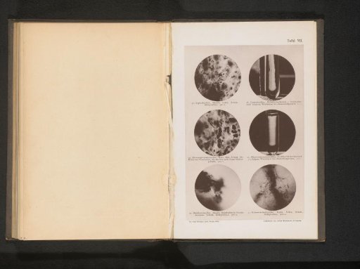 Six microphotographs of bacteria, including typhus and cholera bacilli