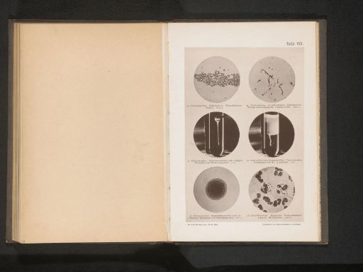 Six microphotographs of bacteria, including the cholera bacillus
