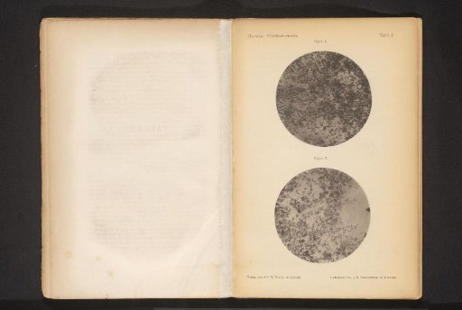 Two microscopic photographs of spoilage bacteria