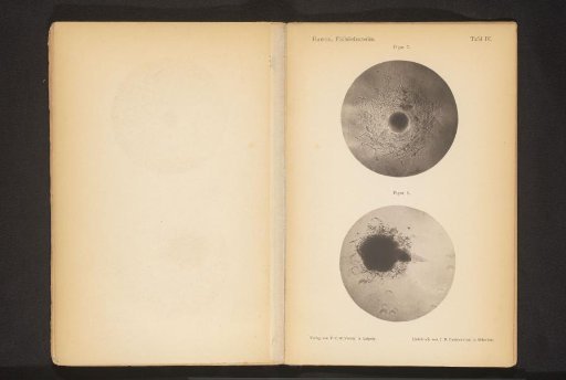 Two microscopic photographs of spoilage bacteria