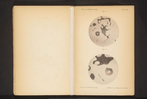 Two microscopic photographs of spoilage bacteria