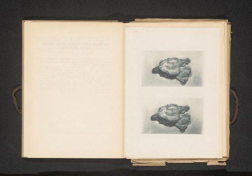 Two views of a prostate with hypertrophy of the lobes