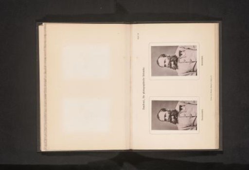 Two Portraits of an Unknown Man with Military Decorations, with and without Retouching
