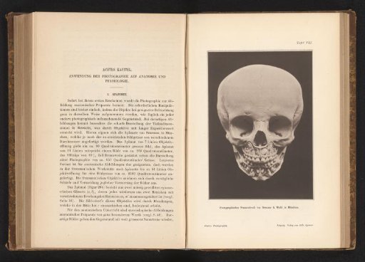 Child's Skull with Mixed Dentition