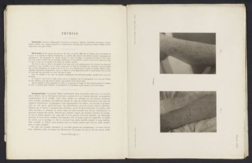 Patients suffering from the skin disease 'prurigo'