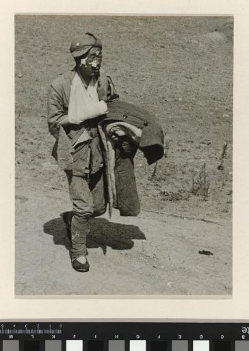 Wounded Soldier in the Battle of Tai'erzhuang, at the Front of Xuzhou, China