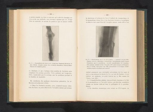 Journal de Radiologie (Belgium), 1909