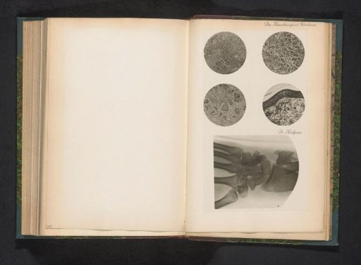 Four enlargements of X-rays