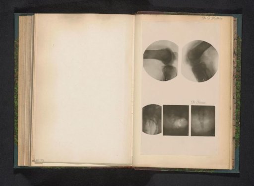 Three X-rays