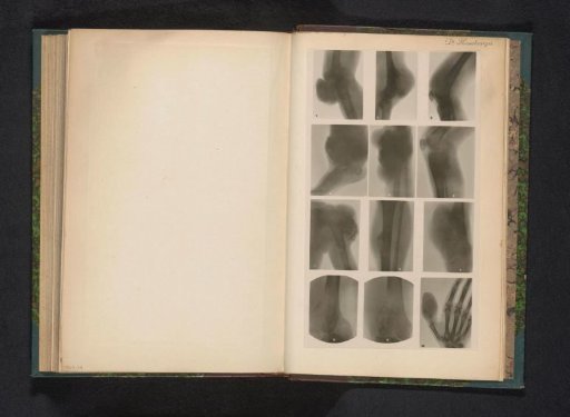 Twelve X-rays of various joints