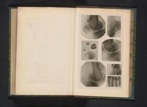 Seven X-rays of various joints and substances