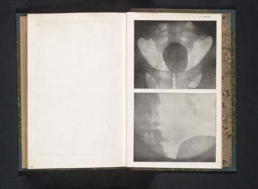 X-ray of a pelvis
