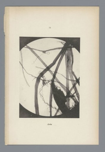 Micrographs of paper fibres