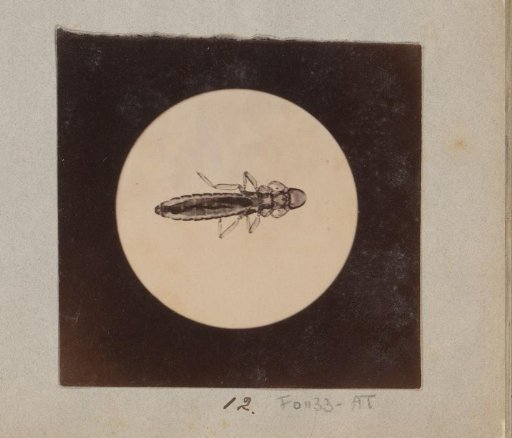 Microscopic image of a chicken louse, magnified 25 times