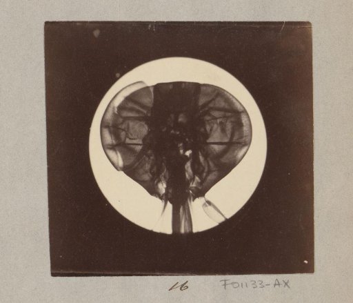 Microscopic image of the head of a fly, magnified 25 times