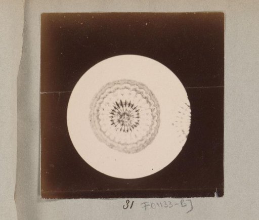 Micrograph of the cross-section of a spine, magnified 25 times