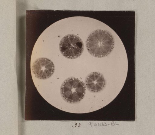 Micrograph of diatoms, magnified 170 times