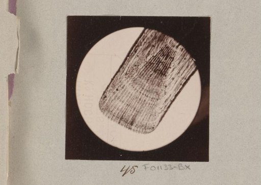 Micrograph of the scale of a tongue, magnified 25 times