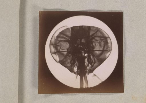 Micrograph of the head of a fly, magnified 25 times