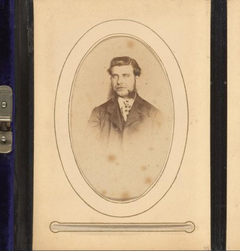 Portrait of a Man with Sideburns