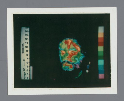 Thermogram of a human head