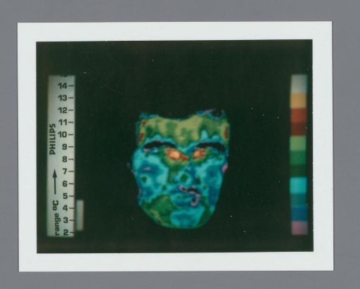 Thermogram of a human head