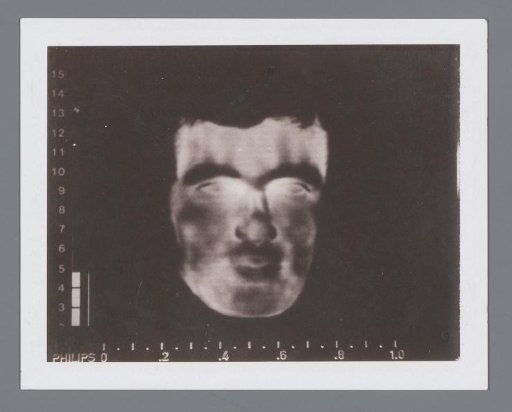 Thermogram of a human head