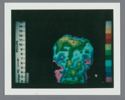 Thermogram of a human head