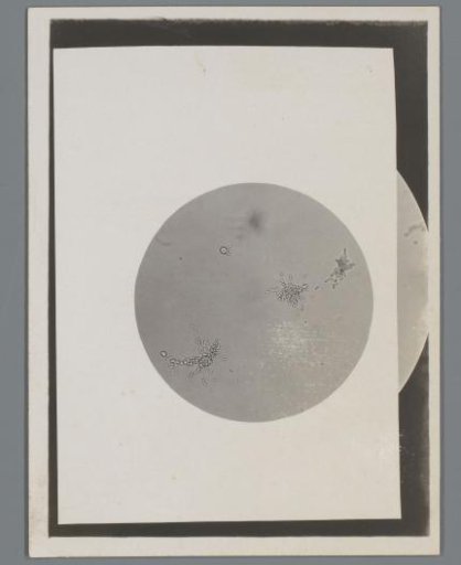 Photograph of a microscopic preparation